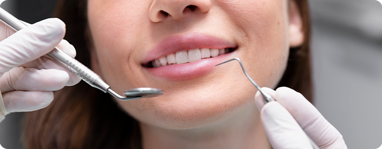 Limpieza dental profesional